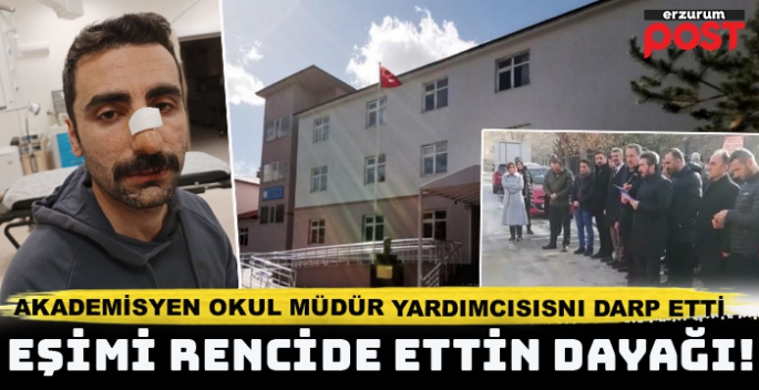 Akademisyen  eş okul müdür yardımcısını darp etti