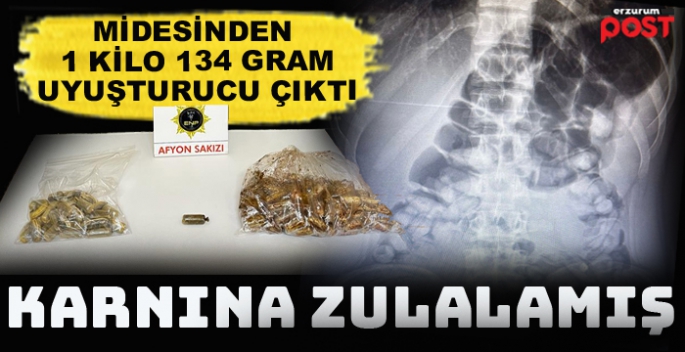 Midesinden tam 1 kilo 134 gram uyuşturucu çıktı 