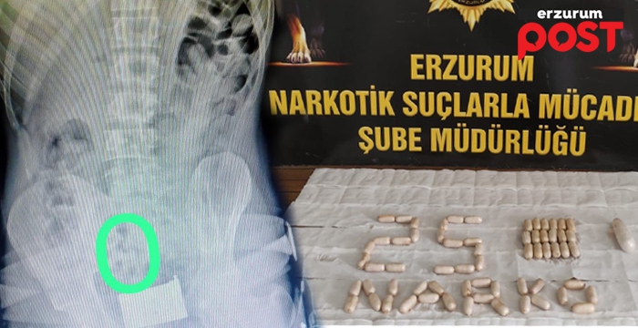 MİDELERİNDEN KAPSÜL KAPSÜL EROİN ÇIKTI